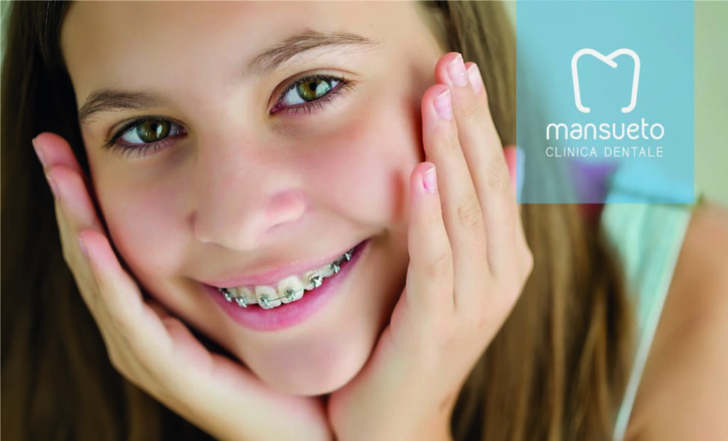 Clinica dentale Mansueto - l'importanza dell'ortodonzia negli adolescenti