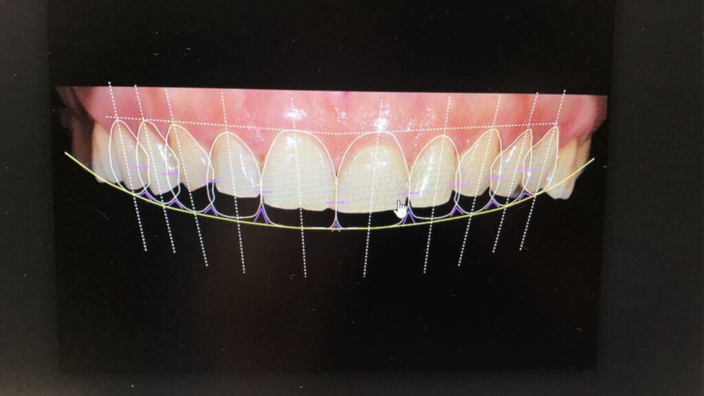 Clinica dentale Mansueto - Smile Design