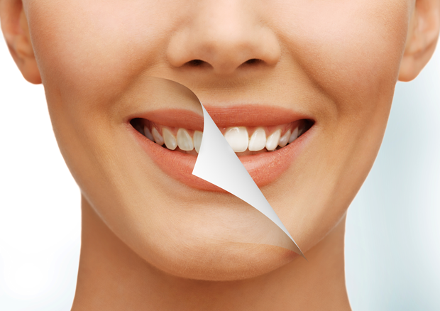 Clinica dentale Mansueto - smile makeover